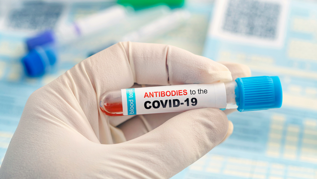 test immunite anticorps londres covid 19 coronavirus