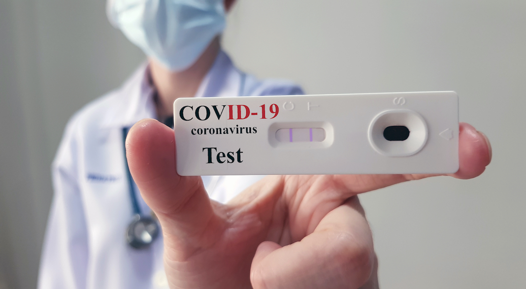 test immunite covid 19 coronavirus